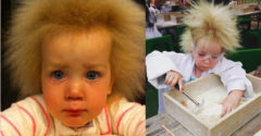Narodila sa s mimoriadne vzácnym ochorením vlasov. Dnes má 11 rokov a sa svoju odlišnosť si už zvykla