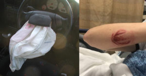 Krvavé odtlačky s logom automobilky po vystrelení airbagu. Ako je to možné?