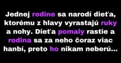 Rodine sa narodí neobyčajne vyzerajúce dieťa (Vtip)