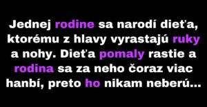 Rodine sa narodí neobyčajne vyzerajúce dieťa (Vtip)