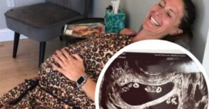 Ultrazvuk odhalil niečo, čomu lekári nemohli uveriť. Pravdepodobnosť takého úkazu je len 1:10 miliónov