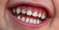 TOTO je dôvod, prečo ľuďom najskôr rastú mliečne zuby a až neskôr prídu trvalé