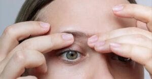 Upozornenie pre ľudí, ktorým sa na tele objavujú drobné biele bodky: Lekárka vysvetľuje, ako sa ich bezpečne zbaviť